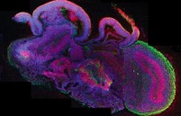 Ученые вырастили в пробирке миниатюрный головной мозг человека