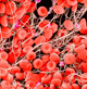 Биоинженерные белки помогут в лечении пациентов с гемофилией