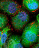 Новые данные об особенностях метаболизма раковых клеток