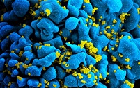 Получены многообещающие результаты лечения ВИЧ с помощью антител
