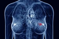 Новая мишень для препаратов от рака груди