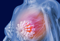 Новые данные о метастазировании рака молочной железы
