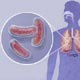 Роль липоксинов в развитии туберкулёза