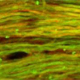 Стволовые клетки – новый подход к клеточной терапии нейродегенеративных расстройств