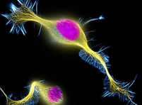 Ученые нашли белок, необходимый для восстановления поврежденных нервов конечностей
